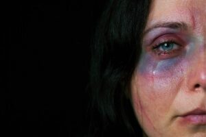 donna che piange con occhio nero