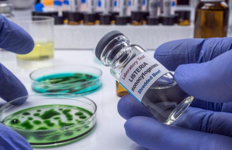 esami di laboratorio sulla listeria