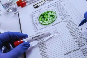 provetta e virus con risultati analisi