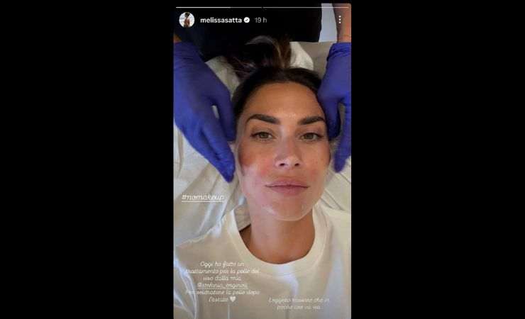 melissa satta fa un trattamento