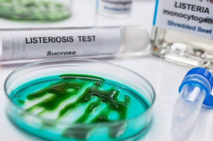 Test laboratorio, provette, campione, Listeria
